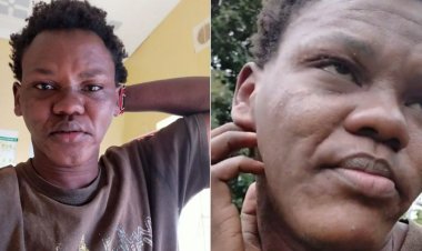 I Did Not Eat A Spider- Viral TikToker Who Ate Bat