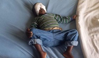 Baby Sagini: Mother Of 3-Yr-Old Whose Eyes Were Gouged Out, Cousin Arrested