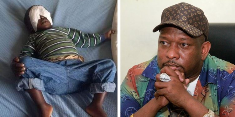 Sonko Plans To Fly Baby Sagini To China For Treatment